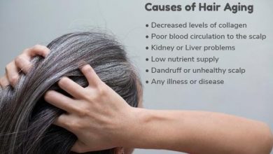 Hair Problems