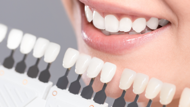 Natural Teeth Whitening