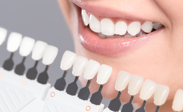 Natural Teeth Whitening