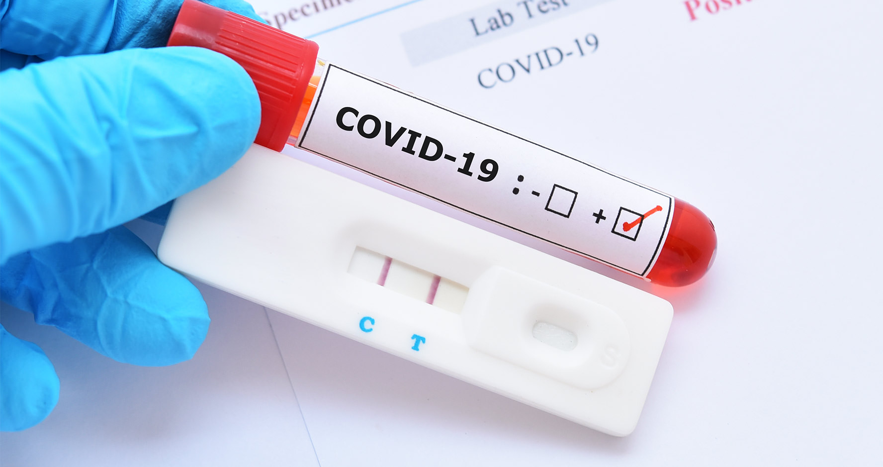 COVID-19 PCR Test