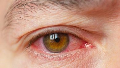 Dry eyes featured image