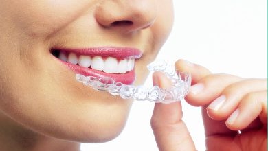 Invisalign Toronto