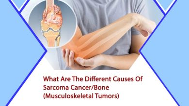 sarcoma