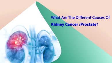 Kidney Cancer