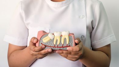 wisdom tooth extraction