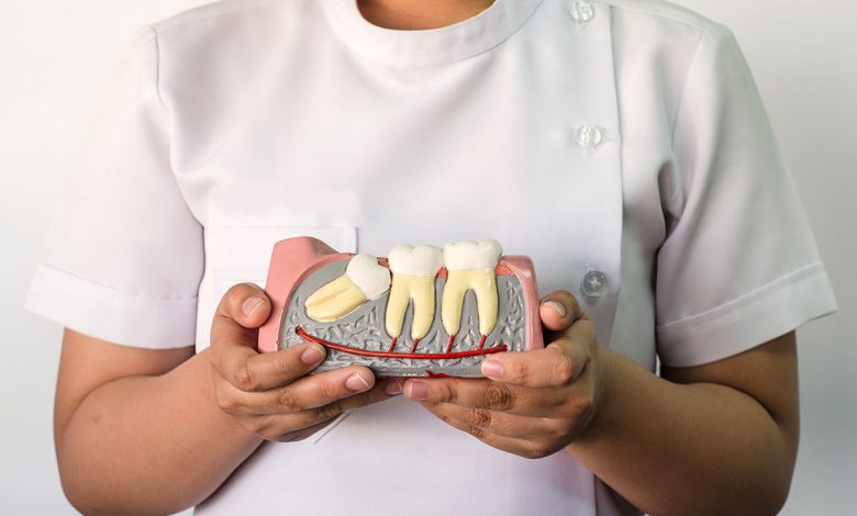 wisdom tooth extraction